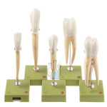 Five dental models